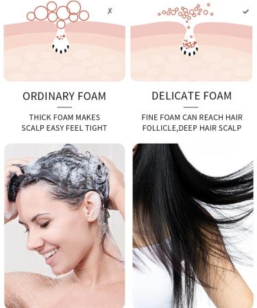 Plant Extract Anti-Hair Loss Hair Shampoo Ginger Anti Hair Loss Shampoo Oil Control Ginger Shampoo Ginger Plant Anti-Hair Loss Hair Shampoo Ginger Shampoo for Women Men Hair 200ML - Buy Online on GoSupps.com