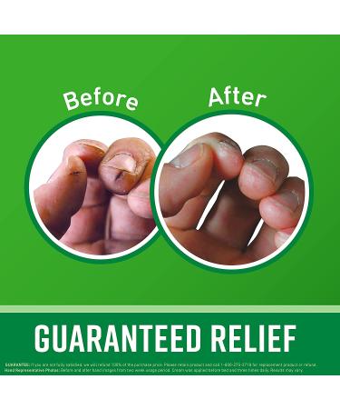 O'Keeffe's Working Hands Hand Cream 6.8 oz Jar (2 Pack) - Moisturizing Formula for Dry Cracked Skin - Buy Online on GoSupps.com