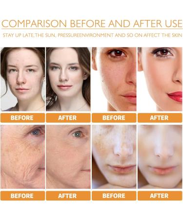 Turmeric Facial Essence Lightens Spots Acne Moisturizes Brightens Moisturizes Skin Essence 30ml - Buy Online on GoSupps.com