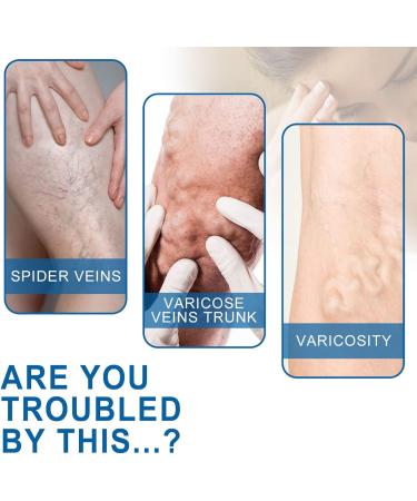 Varicose Vein Treatment Spray & Serum - 2 x 20ml for Spider Veins Relief | Effective Vein Care Cream - Buy Online on GoSupps.com