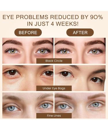 60 patchs Masque Yeux Masque Visage Collagene Hydratant pour Les Yeux Anti Rides Anti Poche pour Femmes et Homme soulager la fatigue et Ridules Soins Des Yeux - Buy Online on GoSupps.com
