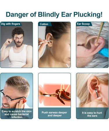 Hotodeal Rechargeable Ear Wax Removal Kit - Portable Ear Cleaner with 3 Modes & 8 Soft Tips for Effective Earwax Removal - Buy Online on GoSupps.com