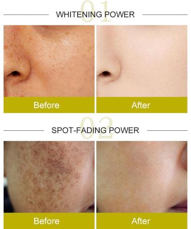 2023 New Turmeric Oil | Brightening Facial & Body Serum | Non-Fatty Essential Oil for Skin | Ideal for Massage & Home Care - Buy Online on GoSupps.com