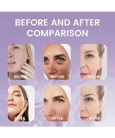 Bakuchiol Serum Natural Retinol Alternative Firm-Hydrating Care Smooths Skin Reduces Fine Lines Wrinkles with Hyaluronic Acid (1Pc) - Buy Online on GoSupps.com