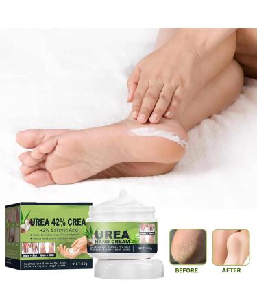 42% Urea Cream with 2% Salicylic Acid Urea Hand Cream for Dry Cracked Skin Repairs Rough Feet & Hands Moisturizes with Coconut & Aloe 50g - Buy Online on GoSupps.com