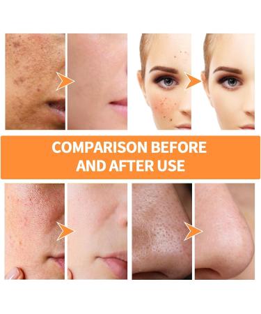  Dous Pore Cleanser | 1.35 Oz Turmeric Clay Vitamin C Remover Mask Soothing Skin Facial Mask for Women and Men to Remove Blackheads Soft Skin - Buy Online on GoSupps.com