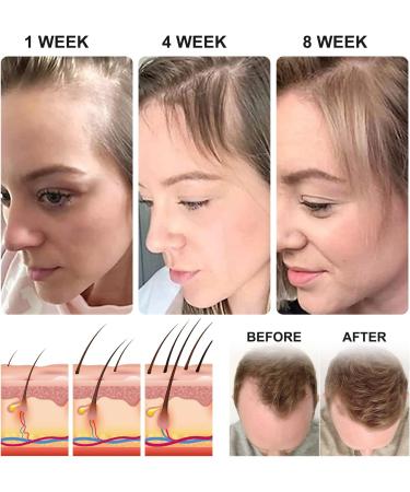 Rice Essential Water Oil for Hair Growth Thickness Strength Shine -100% Pure Natural Leave-in Conditioner for Scalp Dry Split End Moisturizer - Rice Water Oil for Hair Growth&Hair Loss - Buy Online on GoSupps.com