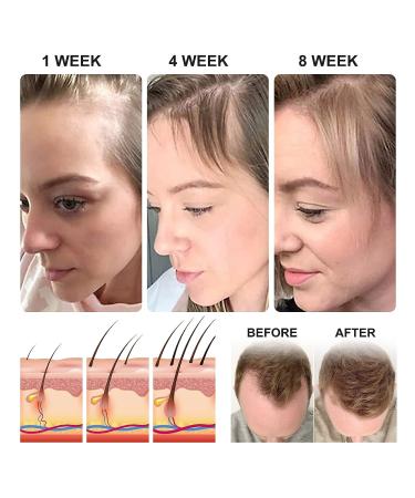 Rice Water Hair Growth & Strength Leave-in Conditioner - 100% Pure Natural Scalp Moisturizer with Vitamins & Minerals - 2.02 fl.oz - Buy Online on GoSupps.com