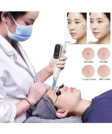 Stylo Picoseconde avec Cran LCD 9 Niveaux De Fr Quence + 4 Niveaux D'Intensit pour Liminer Les Tatouages Cicatrices Grains De Beaut Taches De Rousseur Et Taches Brunes Blue - Buy Online on GoSupps.com