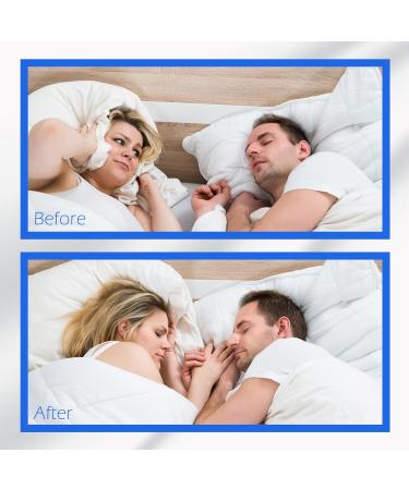 Shop Upgraded Invisible Nasal Strips - Transparent Comfortable & Effective (100 Pack) - International Shipping Available - Buy Online on GoSupps.com