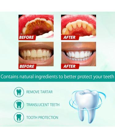 2PC Probiotics Bright Whitening Teeth Mousse & Toothpaste - Deep Cleaning Foam for Gums Stain Remover & Fresh Breath | International Shipping - Buy Online on GoSupps.com