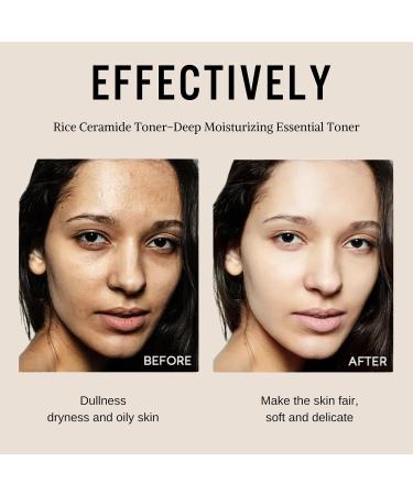 Rice Ceramide Toner Toner for Face Skincare Toner with Niacinamide Hydrating Toner Deep Moisturiser Very Moisturizing Essential Toner Containing Rice Extract Natural - Buy Online on GoSupps.com