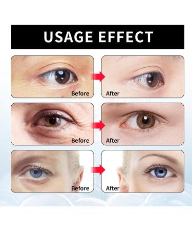 Instant Firmx Eye Tightener - Eye Bag Cream - Instant Firm Eye Cream for Dark Circles - Reduce Eye Bags Puffiness - Fade Fine Lines - Anti-Aging Eye Cream For All Skin - Buy Online on GoSupps.com