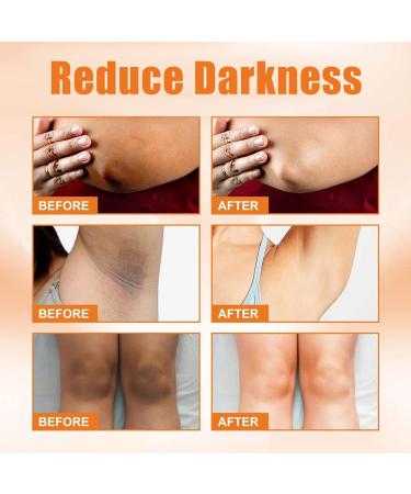 Whitening Cream Underarm Whitening Cream For Dark Armpit Treatment Skin Whitening Cream For Knees With Vitamin C Body Creams For Women Armpit Whitening Cream Lightening Cream For Knees& Elbows&Leg - Buy Online on GoSupps.com