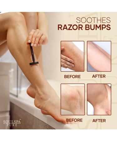 SOULSPA PURE Ingrown Hair Serum - Powerful Razor Bump Solution for Bikini Area Face & Brazilian Wax - Ingrown Hair Oil that Soothes Exfoliates & Nourishes - 2 fl oz - Buy Online on GoSupps.com