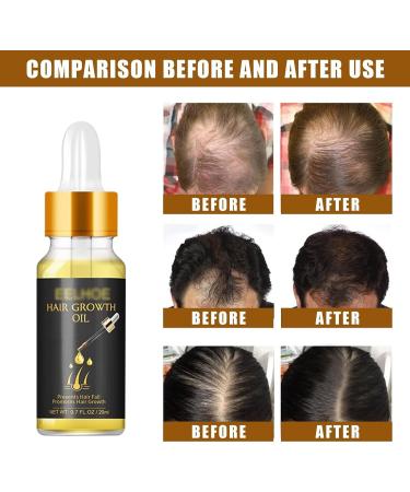 Tress Diary Hair Growth Oil for Black Women and Men Essential Oil for Hair Growth - Buy Online on GoSupps.com