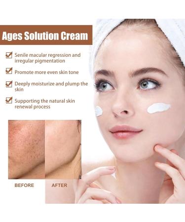 Dark Spot Remover for Face & Body Age Spot Remover for Face Spot Cream Dark Spot Corrector Hyperpigmentation Treatment Freckle Remover Cream Formulated with Nicotinamide Vitamin E Glycerol - Buy Online on GoSupps.com