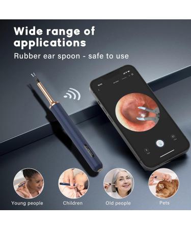 Professional Ear Wax Removal Tool - Safe & Effective | Buy Online - Buy Online on GoSupps.com