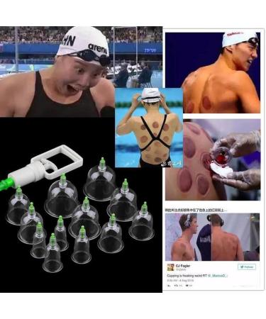 Jiahao Kangzhu Cupping Therapy Set - 24 Biomagnetic Suction Cups Traditional Chinese Massage & Acupuncture for Pain Relief - Buy Online on GoSupps.com