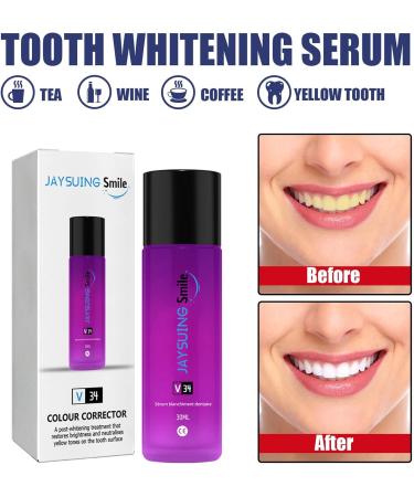 Teeth Whitening Serum - Brighten, Reduce Yellowing, and Cleanse Gums - Buy Online on GoSupps.com