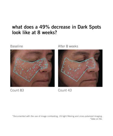 NEOVA SmartSkincare DNA Total Repair Serum 30 mL 1 fl. Oz. | Reduces Wrinkles Uneven Texture & Hyperpigmentation | Sun Damage Repair Serum - Buy Online on GoSupps.com