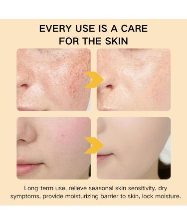 Tallow Face Cream - Moisturiser Face Women - Beef Tallow Face Moisturisers - Beef Tallow Skin Care - Deep Nourish Face Cream - 100% Organic Beef Tallow & Cold Pressed Sweet Almond Oil - Buy Online on GoSupps.com