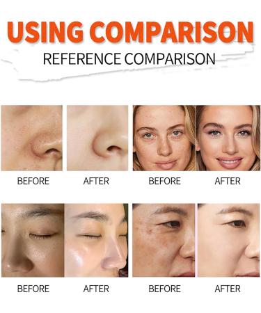 Kojic Acid Soap - Kojic Acid Skin Lightening Soap - Kojic Acid Dark Spot Remover Soap Bar - Reduce Hyperpigmentation Anti Oxidation Even Skin Tone - Moisture Hydrate Restore Elasticity Reduce Dryness - Buy Online on GoSupps.com