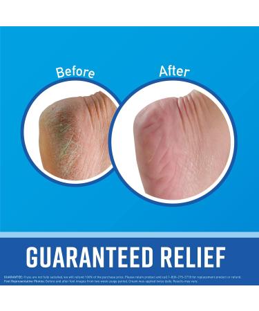 O'Keeffe's Healthy Feet Foot Cream - Guaranteed Relief for Extremely Dry Cracked Feet - Boosts Moisture - 3.2oz Jar (Pack of 2) - Buy Online on GoSupps.com