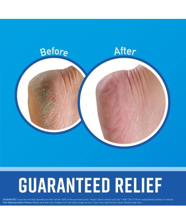 O'Keeffe's Working Hands & Healthy Feet Cream Set - 3.4oz & 3.2oz | Best Hand & Foot Care for Dry Skin - International Shipping Available - Buy Online on GoSupps.com