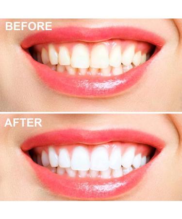 Silicone Bite Track Tooth Bleaching Gear | Teeth Protection Splint for Grinding & Sports | Mouth Guard for Whitening - Buy Online on GoSupps.com