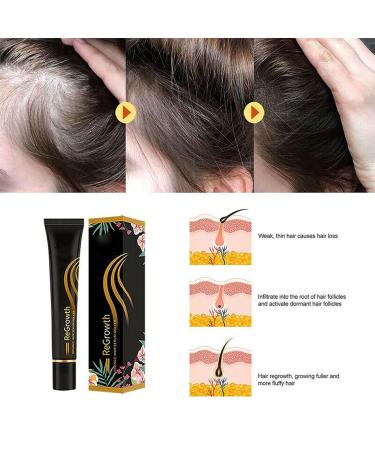 20ml Organic Hair Regrowth Serum Roller Set | Herbal Scalp Intense Roll-On for Men & Women | Triple Massager Hair Growth Essence (3PCs) - Buy Online on GoSupps.com