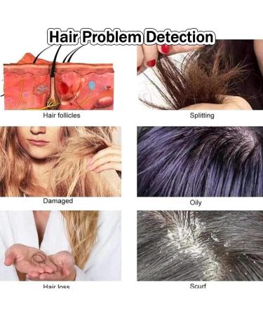 Scalp Hair Follicle Detector Professional Skin Diagnostic Hair Analyzer Scalp Microscope Skin Moisture Analyzers Skin Diagnosis Scanner Provides Clearer Detection - Buy Online on GoSupps.com