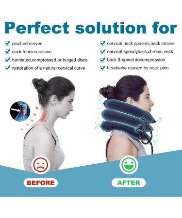 Buy Tkmars Adjustable Neck Traction Device - Inflatable Cervical Spine Relief for Travel & Office Painful Neck & Shoulder Support Blue - Buy Online on GoSupps.com