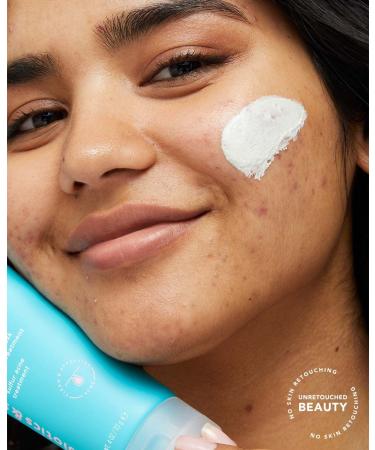 TULA Skin Care Clear Skin Starters - 3-in-1 Acne All Star Set - Buy Online on GoSupps.com