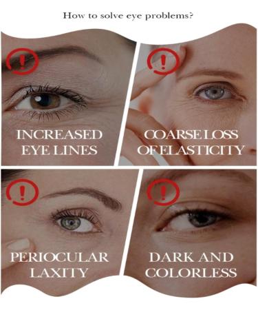 Under Eye Patches Avocado Eye Masks for Puffy Eyes Collagen Eye Patches for Dark Circle Under Eye Gel Patches Under Eye Mask Under Eye Bags Fine Lines & Wrinkles Hydrating Skincare 30 Pairs - Buy Online on GoSupps.com