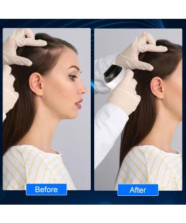 Facial Roller Needles Dermaroller Face with Needles Professional Derma Needle Roller Microneedling Hair Roller 0.5 mm Roll Beard 1200 Derma Roller Needles for Facial Hair and Beard Care - Buy Online on GoSupps.com