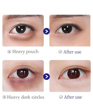 Yniquet 2PCS Age Correcting Eye Cream Collagen Moisturizing Eye Cream for Anti Aging Eye Serum for Dark Circles Puffiness and Bags for Women Nourishing Repair Tightening and Lifting - Buy Online on GoSupps.com