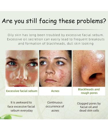 Acne Cream Moisturiser Face Cream Spot Cream Mens Moisturiser Tea Tree Cream Spot Cream For Acne Cream Moisturiser for Women Men Teenagers Dilute Face Prone Spot Marks Balance Facial Oil Cream - Buy Online on GoSupps.com