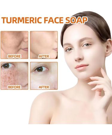 Turmeric Soap Bar | Turmeric Face Soap | Turmeric Soap Dark Spot Remover For Face And Body Moisturizing Bath Soap Even Tone Skin - Buy Online on GoSupps.com