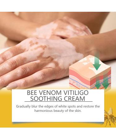 Foot Cream - Care Lotion | Nourishing and Illuminating Plant Extracts to Moisturize Dry Sensitive Skin on the Body and Hands - Buy Online on GoSupps.com