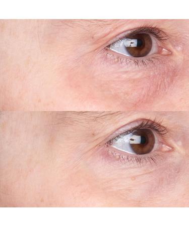 Perricone MD Cold Plasma Plus+ Daily Defense Moisturizer SPF 35 - Anti-Aging Hydration 1 fl. oz. - International Shipping Available - Buy Online on GoSupps.com