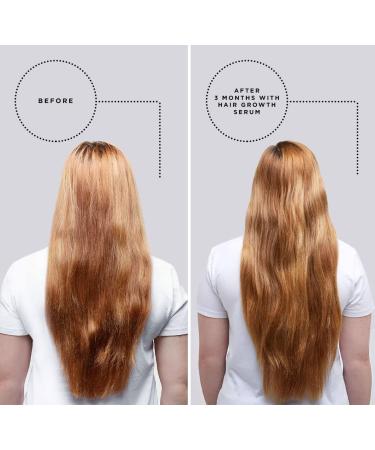 Grow Gorgeous Daily Density Serum 60ml - Vegan & Gluten-Free Hair Serum for Fuller, Thicker Hair - Targets Thinning and Hair Loss - Buy Online on GoSupps.com