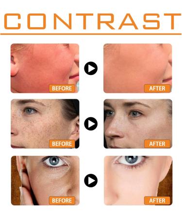 Sunscreen Spf 100 - Face Sunscreen - Waterproof Sun Cream with Spf 100 - UVB/UVA Protection Fator 100 Sun Cream - Spf 100 with Moisturiser anti Wrinkle Prevent Sunburn&Taning - Buy Online on GoSupps.com