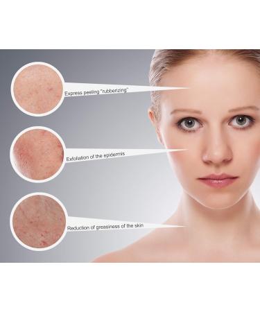 Floslek Fruit Acid Peeling - 125g AHA Face Mask for All Skin Types | Effective Gommage for Mess Pimples & Pustules | International Shipping Available - Buy Online on GoSupps.com