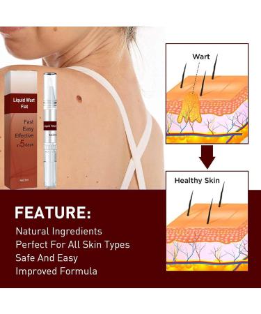 Skin Tags & Moles Remover - Fast & Effective Liquid Pen - 2PC Set - Buy Online on GoSupps.com