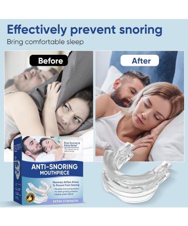 Memonotry Snoring Aid Mouthpiece - Shapeable Anti-Snoring Device for Men/Women - Stop Snoring Comfortably - 1PCS - Buy Online on GoSupps.com