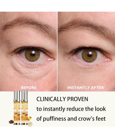 Helbr Bee Venom Firming Eye Cream 2PCS Anti-Aging Firming Lifting & Hydrating Bee Venom Cream for All Skin Types Bee Venom Skin Treatment to Reduce Wrinkles and Fine Lines 1.04oz - Buy Online on GoSupps.com