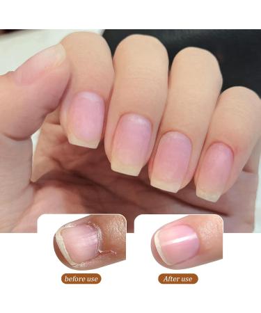 Nail Cuticle Remover Pretreatment Liquid Nail Auxiliary Softener Grinding Machine Softened Dead Skin Nail Art Manicure Nail Cuticle Remover - Buy Online on GoSupps.com