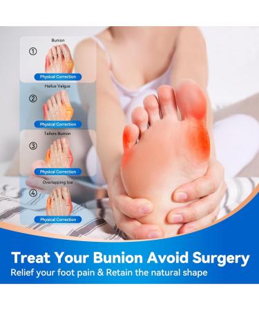 Buy Lilbitty Hallux Valgus Corrector Socks - Big Toe Pain Relief Hammer Toe Separator & Spacer - Buy Online on GoSupps.com