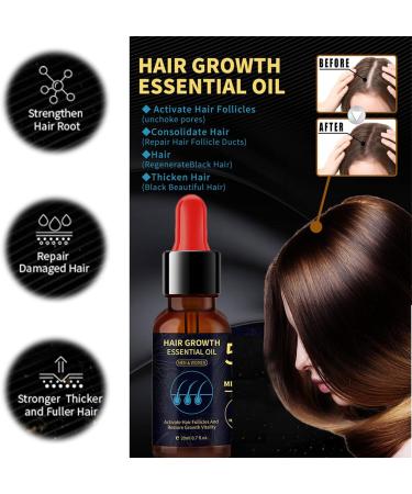 Nourishing Hair Growth Oil Serum for All Hair Types - Stimulates Scalp, Thickens and Promotes Density - 1pcs - Buy Online on GoSupps.com